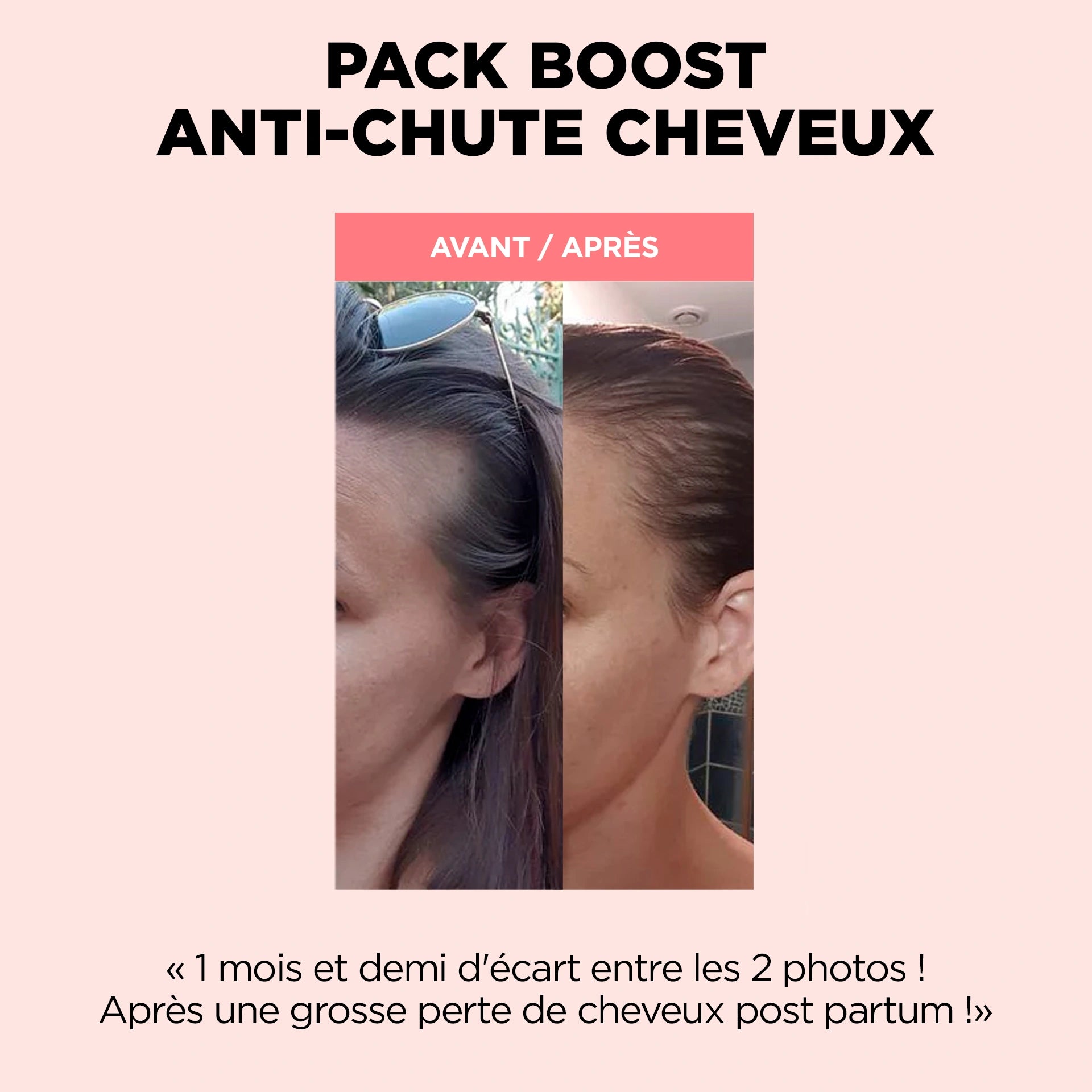 Pack Boost Anti-chute Cheveux