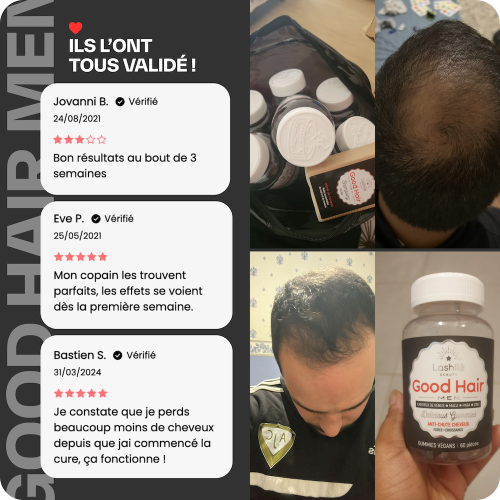 Good Hair Men Tratamiento anticaída para hombres - 6 meses